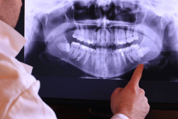 Best Emergency Dentist for Knocked-Out Tooth in Coldstream, OH